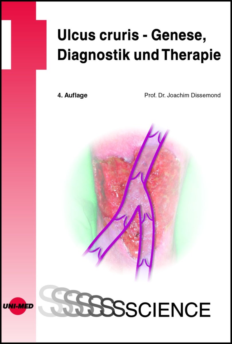 Ulcus cruris - Genese, Diagnostik und Therapie