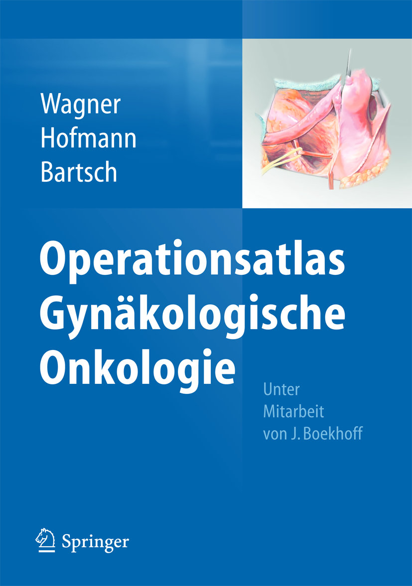 Operationsatlas Gynäkologische Onkologie