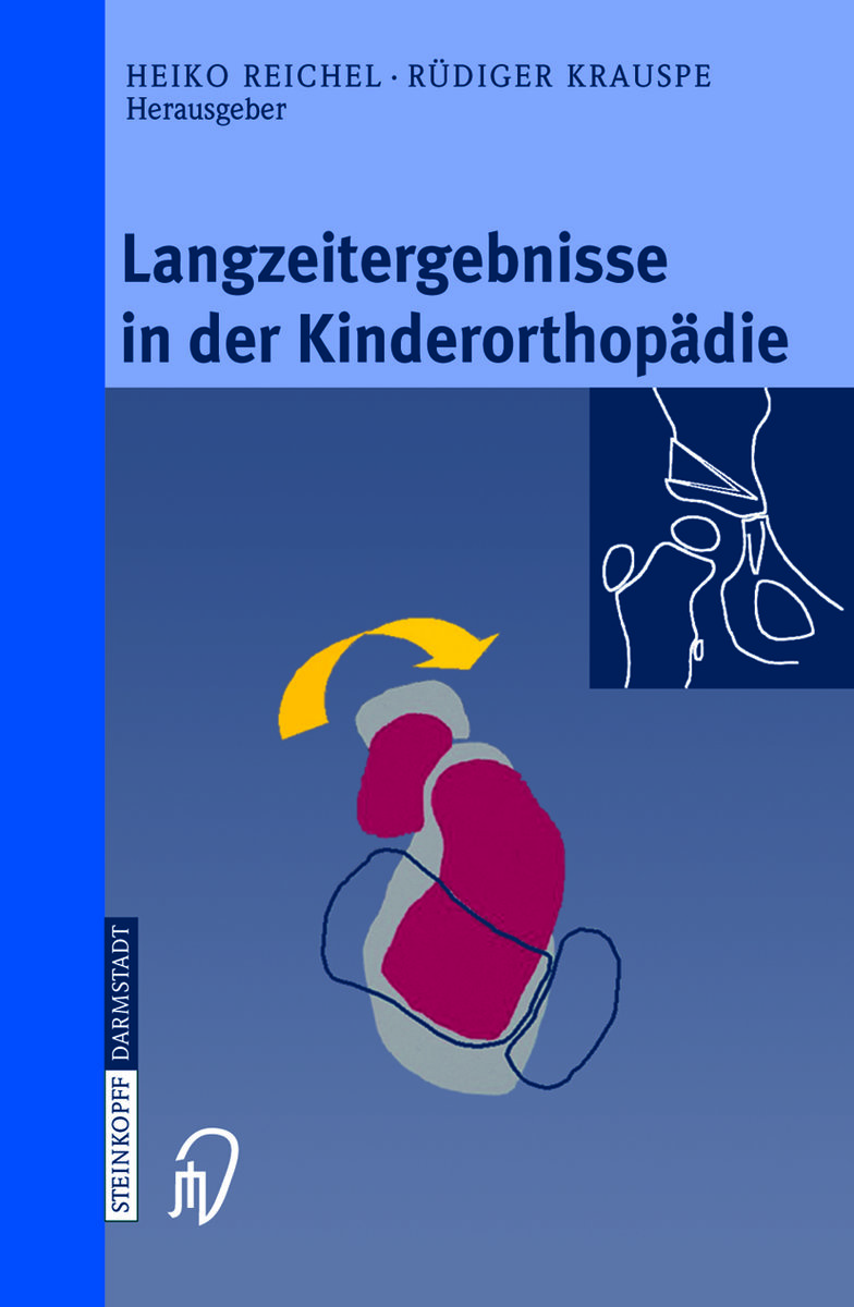 Langzeitergebnisse in der Kinderorthopädie