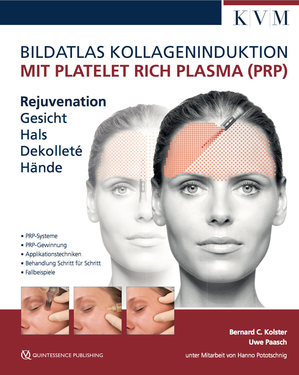 Bildatlas Kollageninduktion mit Platelet Rich Plasma (PRP)