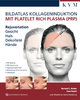 Bildatlas Kollageninduktion mit Platelet Rich Plasma (PRP)