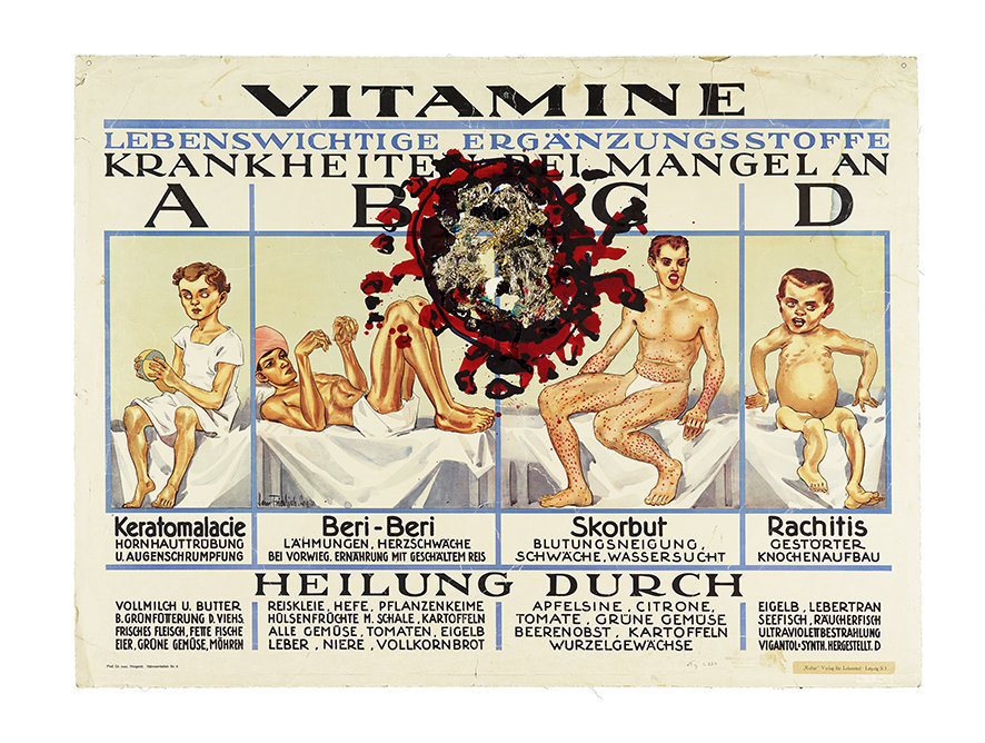 Befallerscheinungen/Veneral Diseases/Maladies Vénériennes