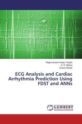 ECG Analysis and Cardiac Arrhythmia Prediction Using FDST and ANNs