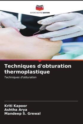 Techniques d'obturation thermoplastique